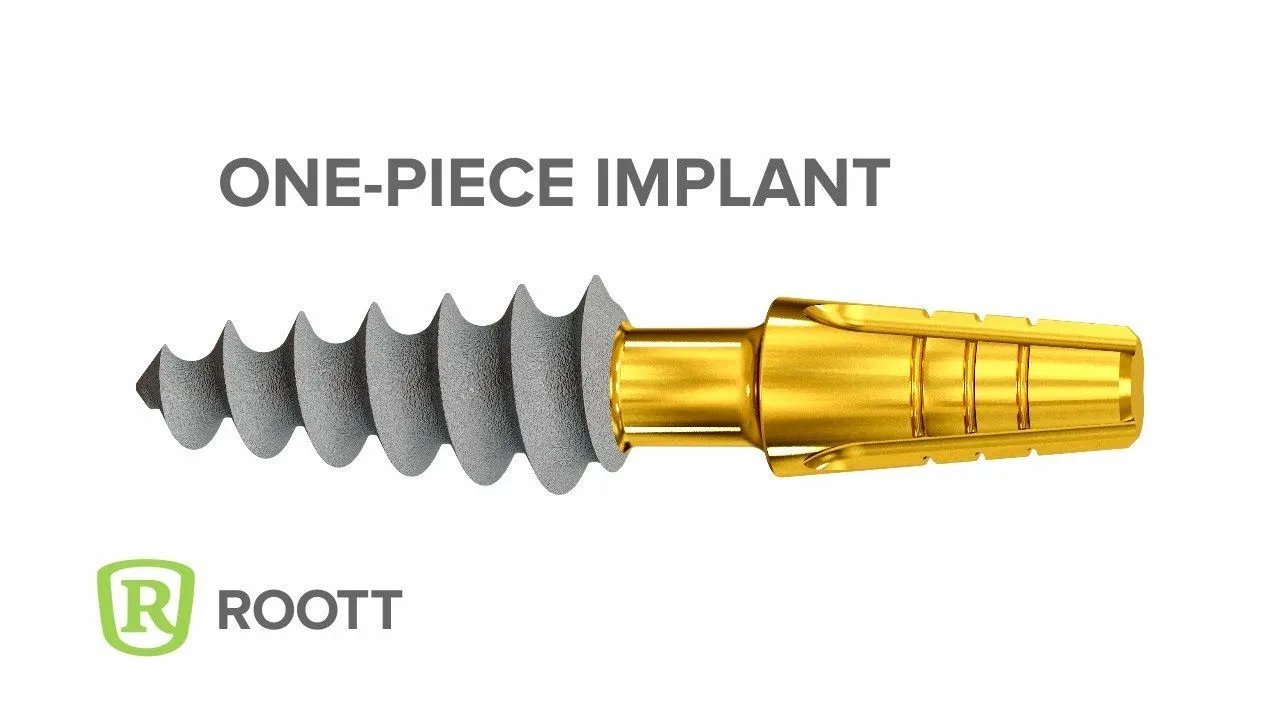 Implant Roott compresive